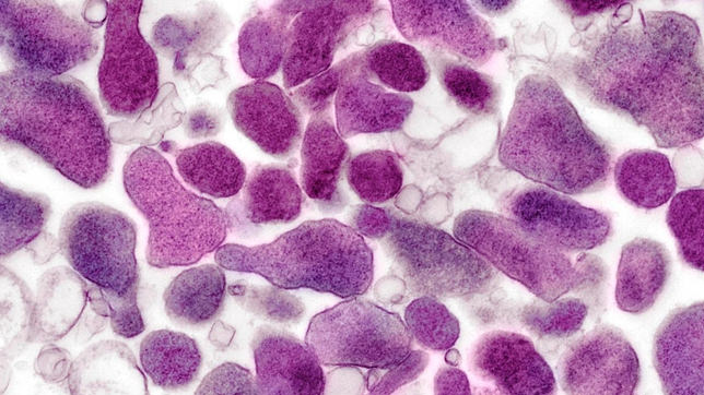Mycoplasma Genitalium, la nueva infección de transmisión sexual